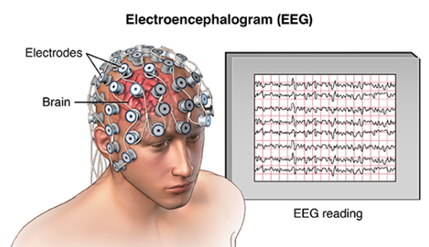 EKG Cihazı